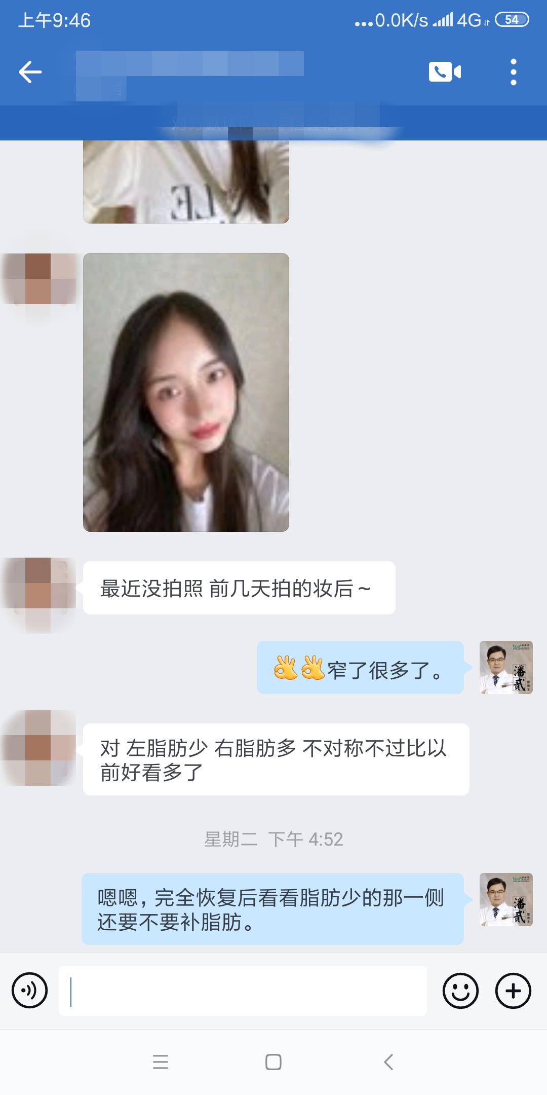 割双眼皮失败女的视频最新,割双眼皮失败女网红