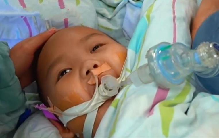 8岁儿童脑部肿瘤的症状10大前兆,儿童脑肿瘤手术得多长时间