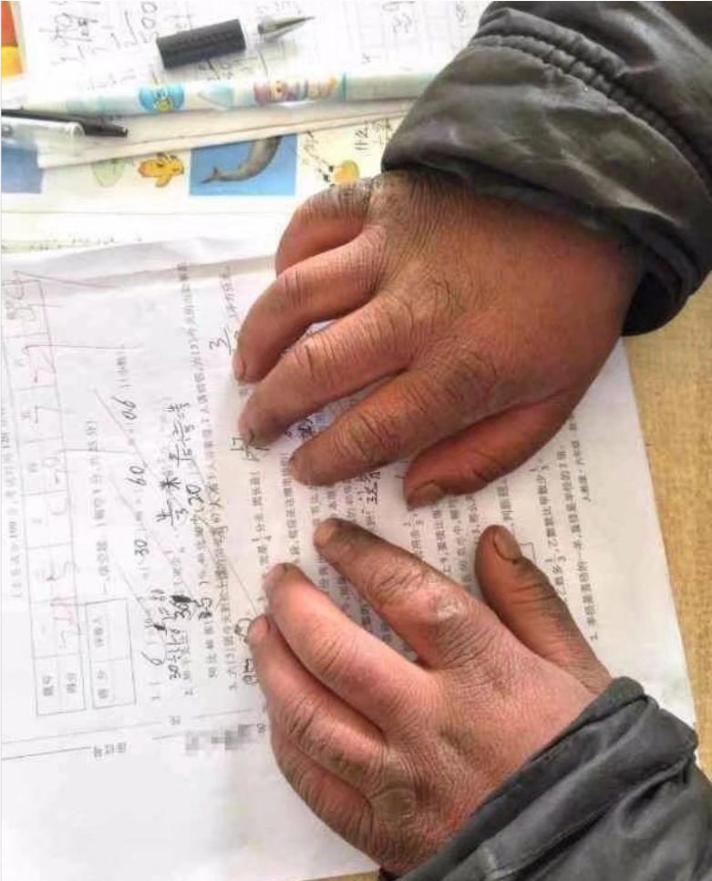 3岁被冻的孩子现在怎么样了,小男孩被冰冻三百年