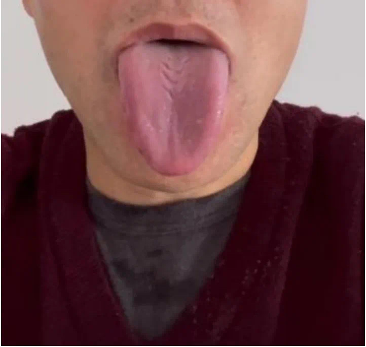 中医怎样治焦虑性失眠,治失眠焦虑有什么中药