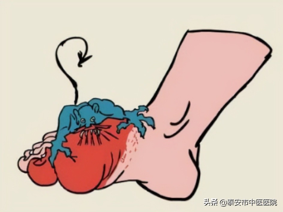 微创技术治疗疼痛,微创手术除病痛