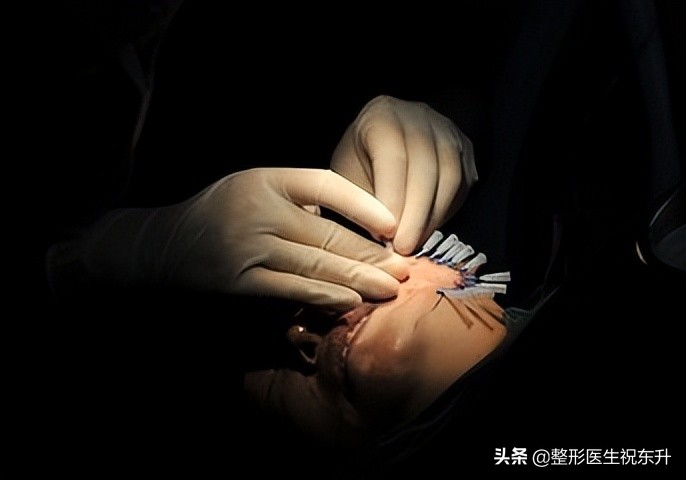 想变年轻不一定非要整形,想变年轻的看过来