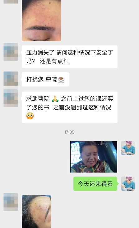 玻尿酸栓塞几个小时内出现问题,栓塞玻尿酸栓塞的概率高吗