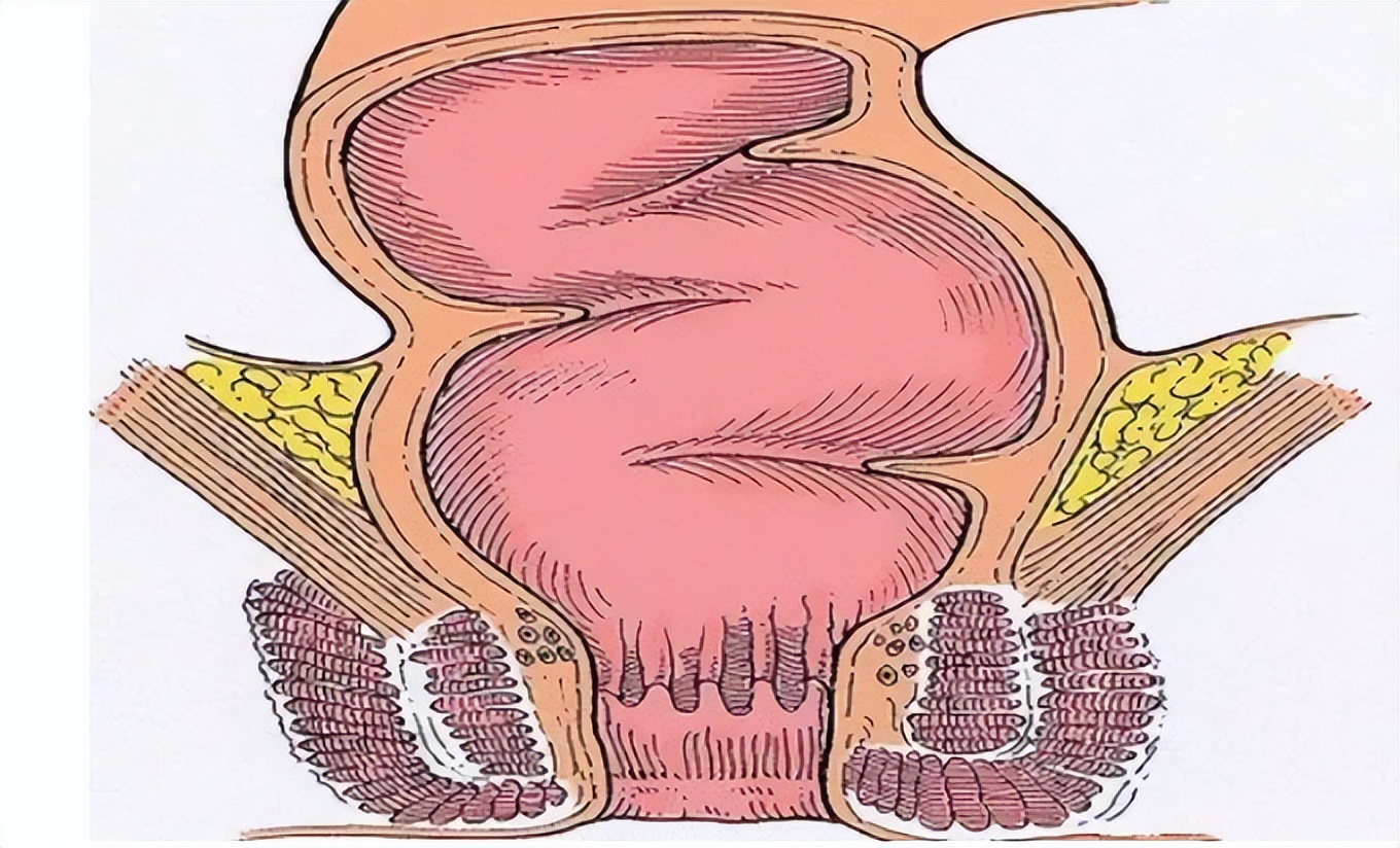 “肛门癌”是什么疾病,危险吗?出现4个症状,及时就医检查