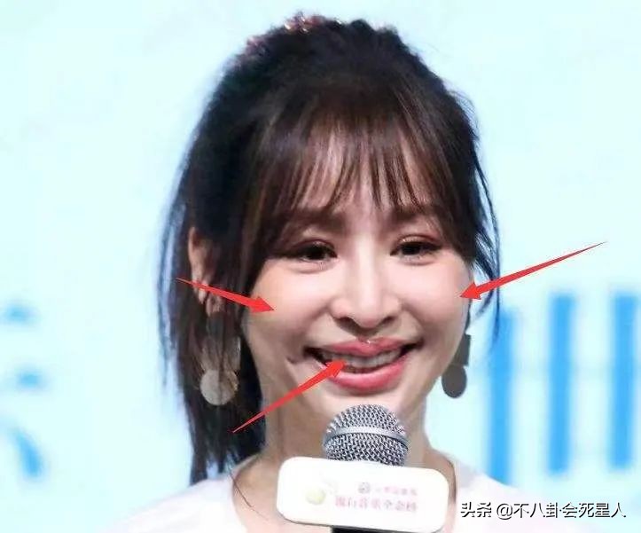 杨雪的脸怎么了,杨雪毁容了吗