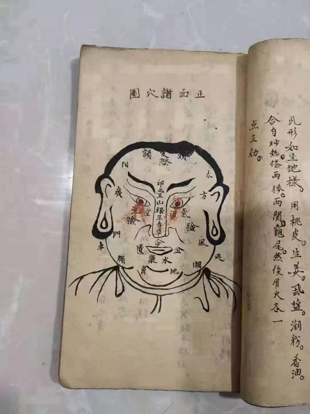 火灸疗法的书,藏医火灸疗法书