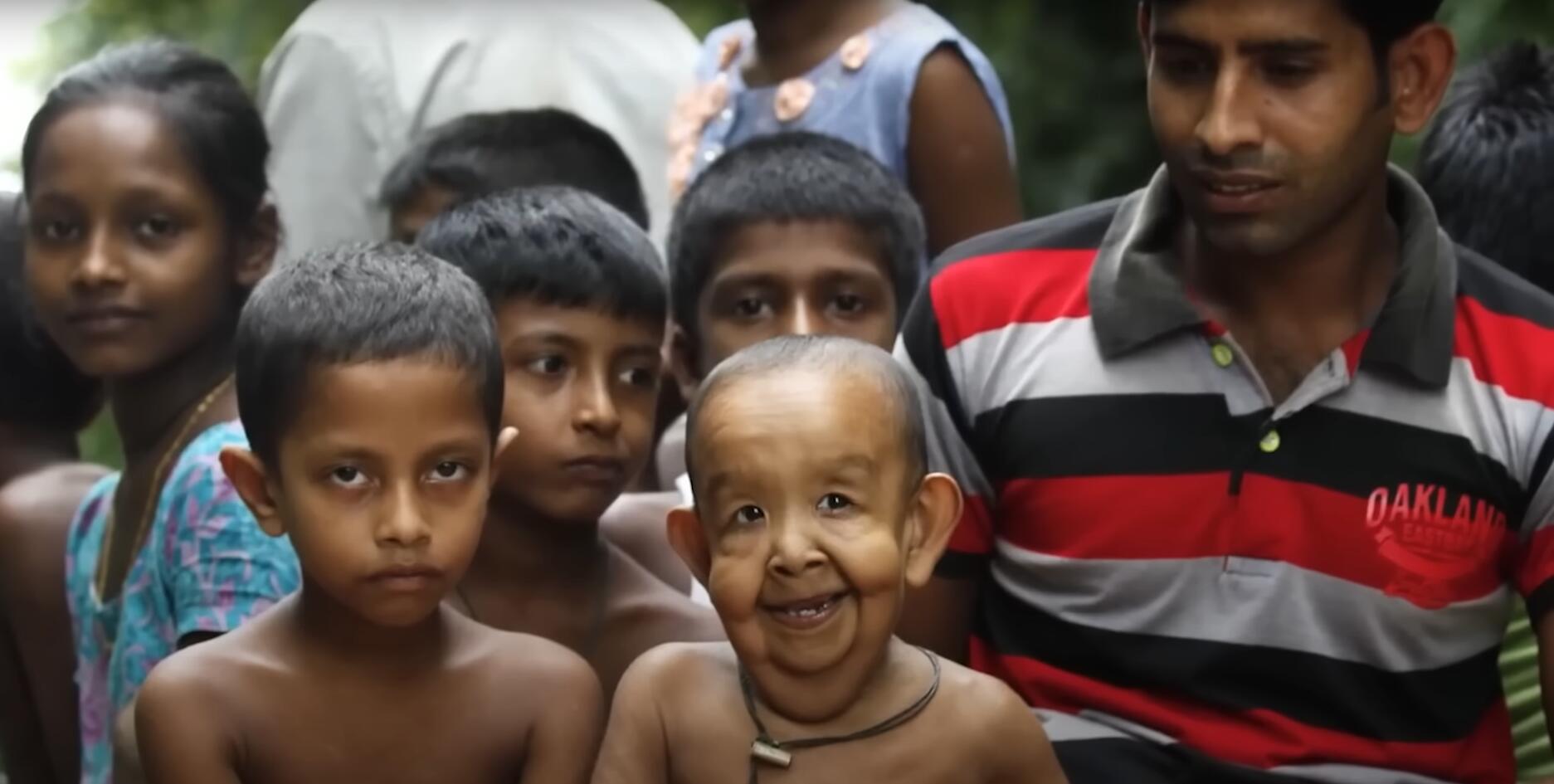 10个难以置信的人类，树皮人、外星人、拥有粗壮手臂的大力水手