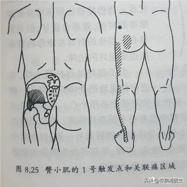 臀部到腿疼痛怎么回事,臀部到大腿筋疼怎么缓解