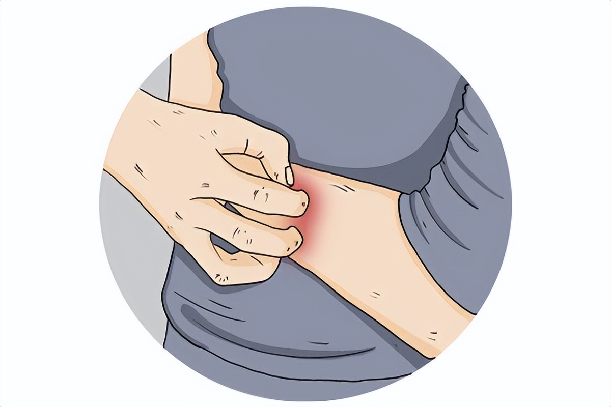 阴虱是什么？为什么现在很多人得阴虱？医生：离不开3个传播途径