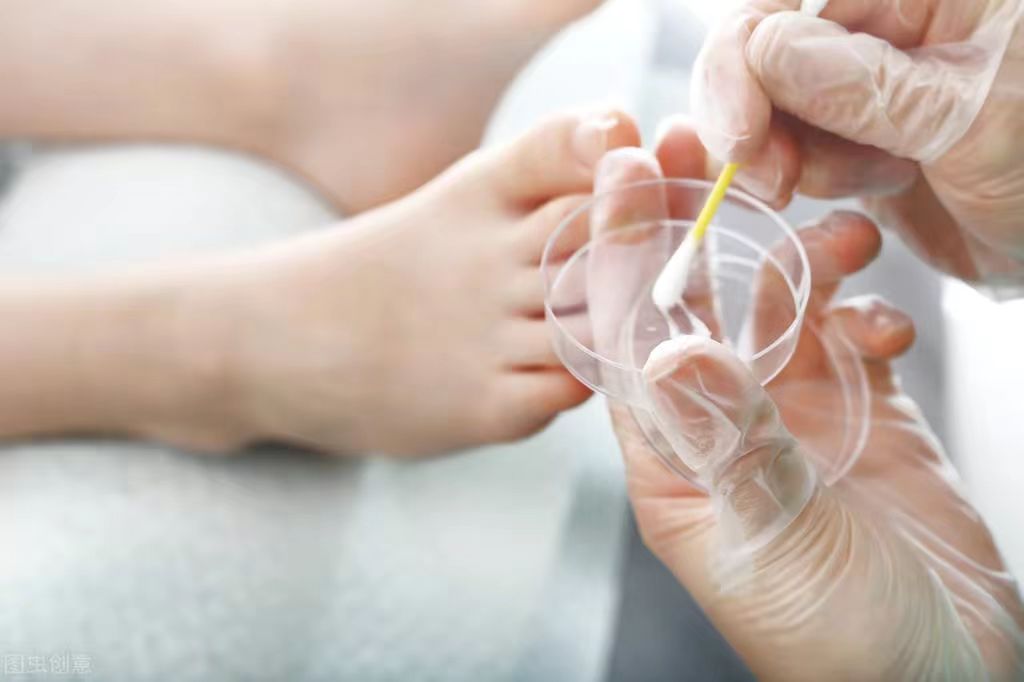 湿疹和带状疱疹哪个更严重,带状疱疹湿疹用什么草药