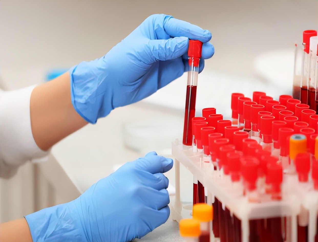 糖尿病肾病患者使用口服降糖药,治疗肾病降尿蛋白效果比较好的药