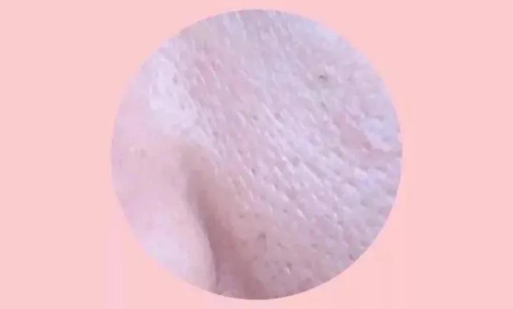 几款解决毛孔粗大的实用方法,毛孔粗大最全攻略解决办法