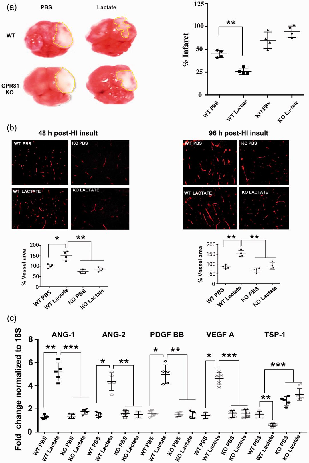 誉嘉医学文献分析｜新生儿缺氧缺血性脑损伤后还可以恢复吗？能