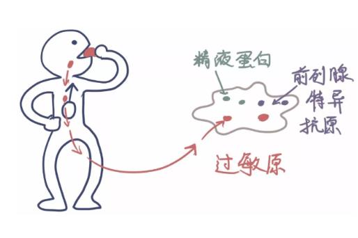 妻子对丈夫的精华过敏，还能同房和生娃么？听听医生怎么说