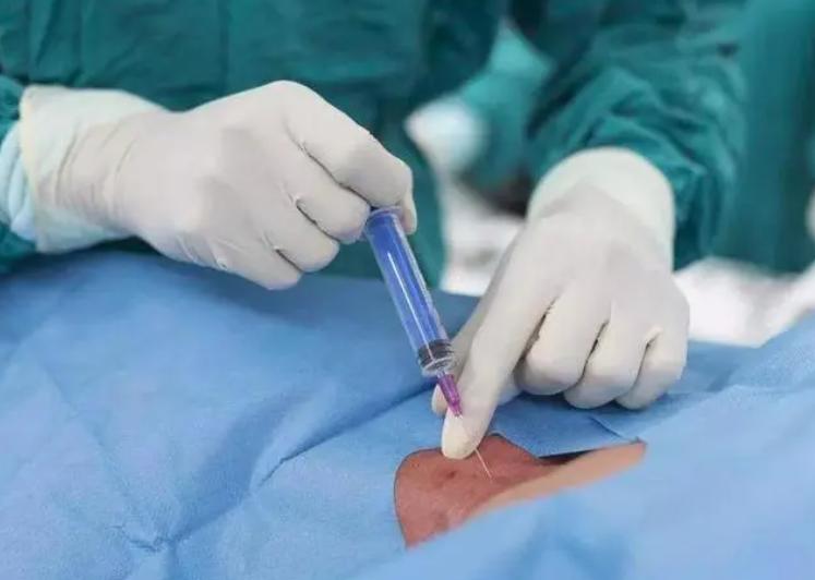 剖宫产手术，不同的全身麻醉方法有啥区别？对胎儿健康影响不同！