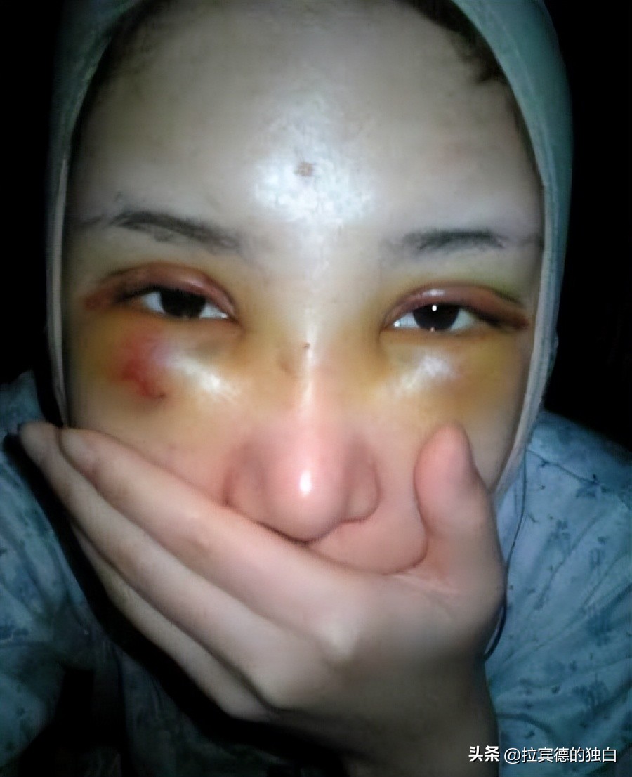 郭美美网红时期,郭美美事件纪录片