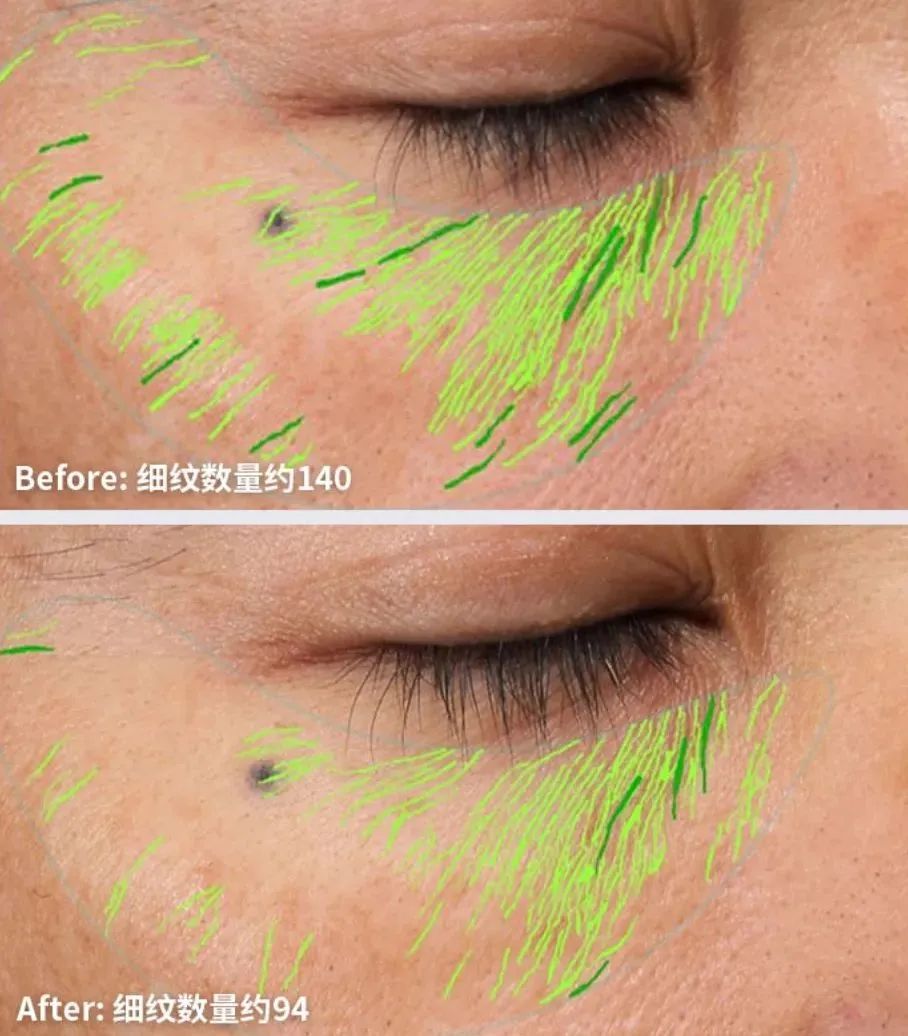 香港冻龄女神,香港冻龄女星出席活动谈保养