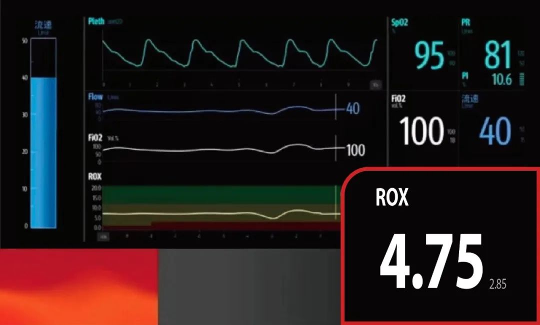 无创呼吸机一新亮点,无创通气和有创通气的优缺点
