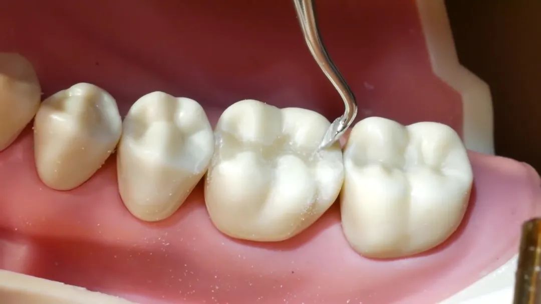 补过的牙齿疼吃什么药,为什么刚补完牙齿牙齿就痛