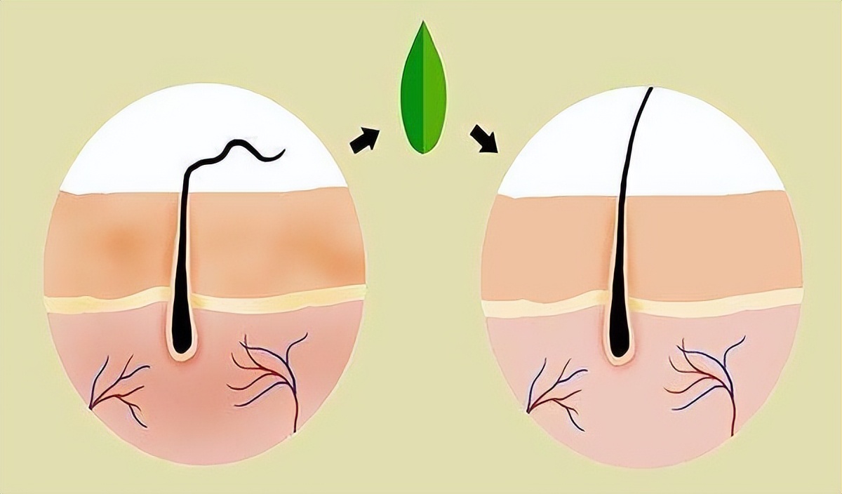 头皮上总出油长有疙瘩或脓包,头皮有疙瘩脓包痒痒用什么药