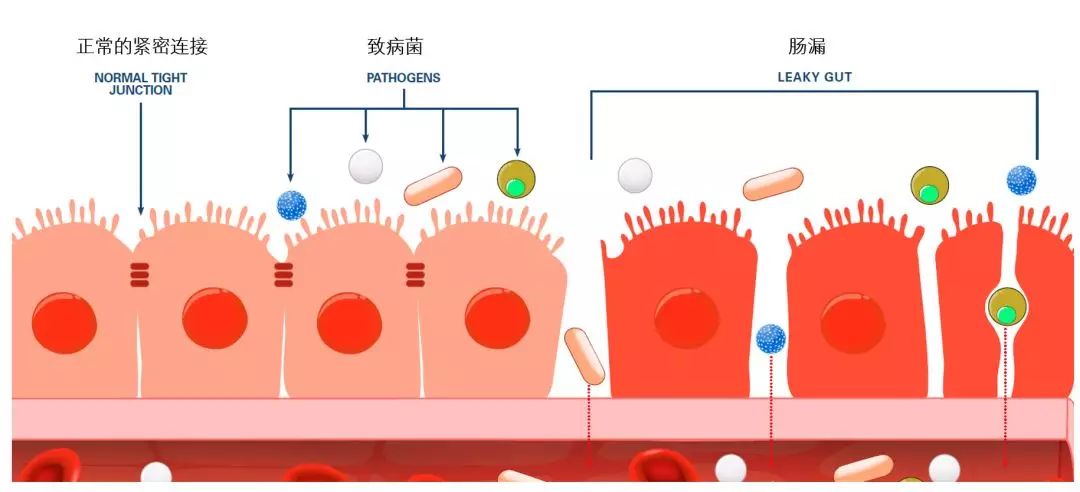 肠道不好有点漏便怎么回事,肠漏会引起什么病