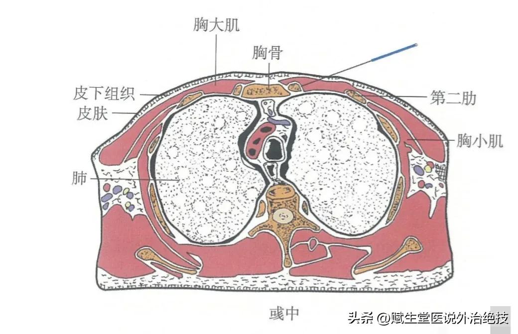 治咳嗽要穴,咳嗽穴一按就好