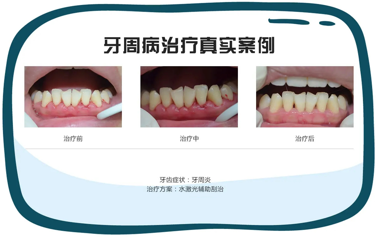 认识牙齿保护牙齿,认识牙齿预防蛀牙课件