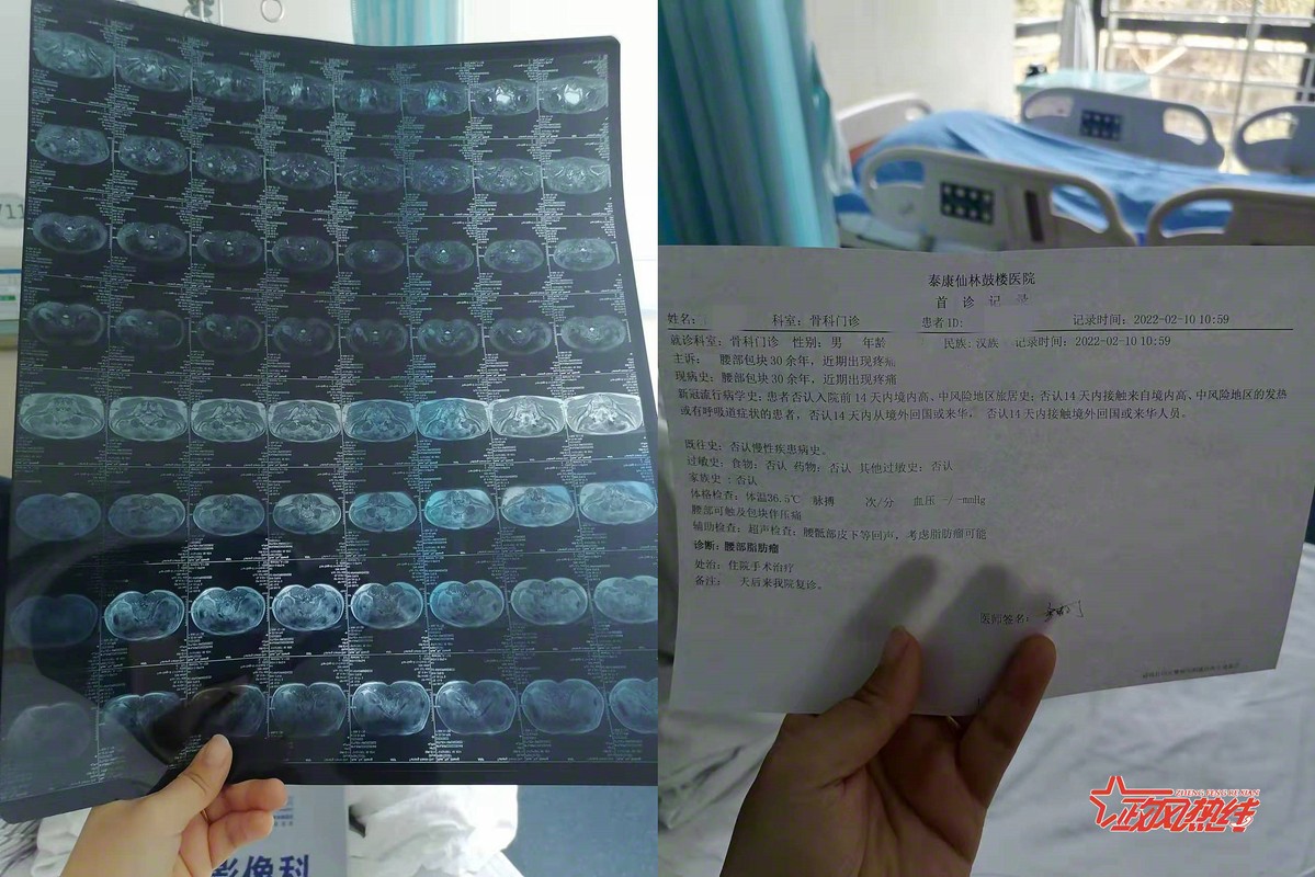 南京市第一医院做手术,南京选择医院做手术