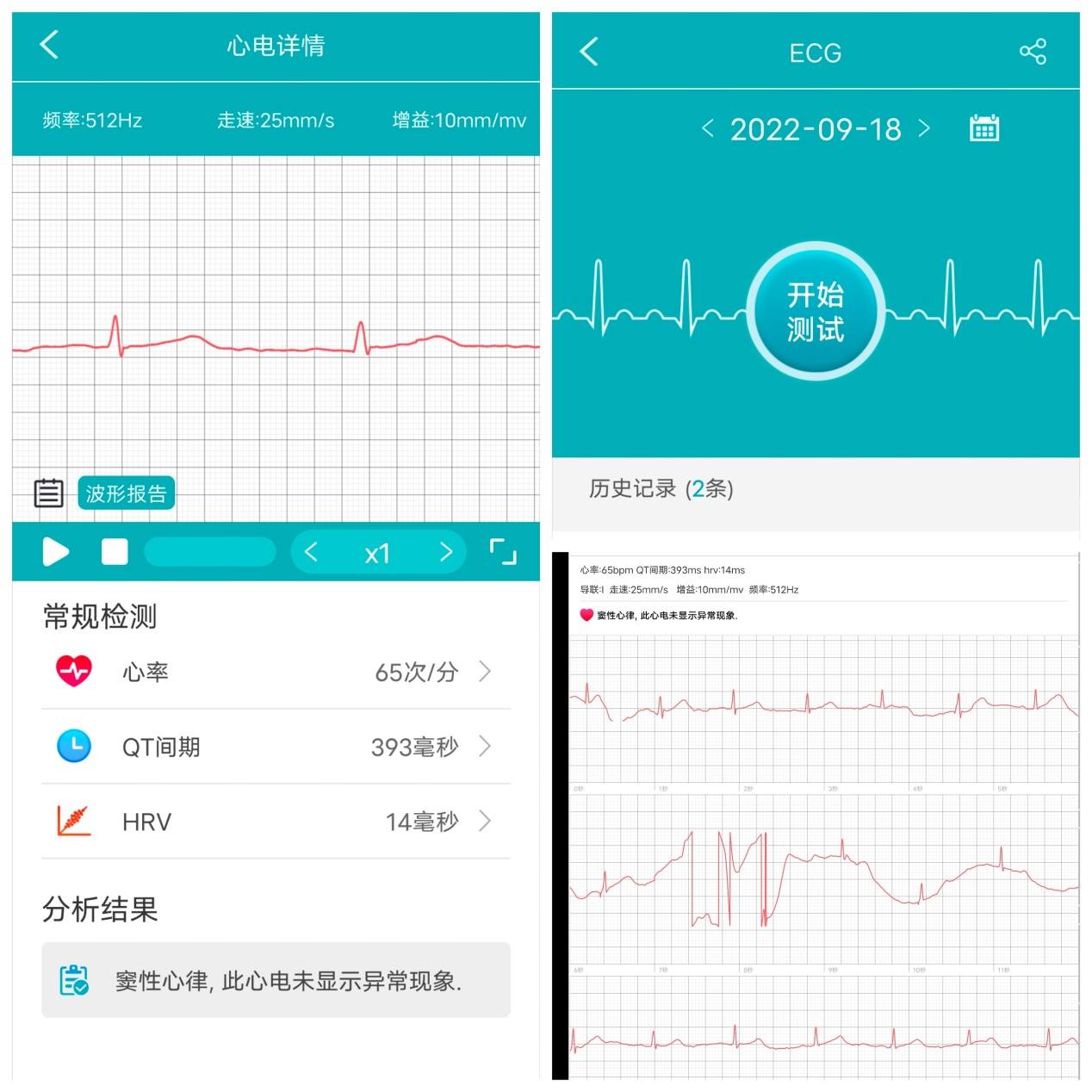 dido智能血压手表哪款最好,dido智能血压手表g28sport