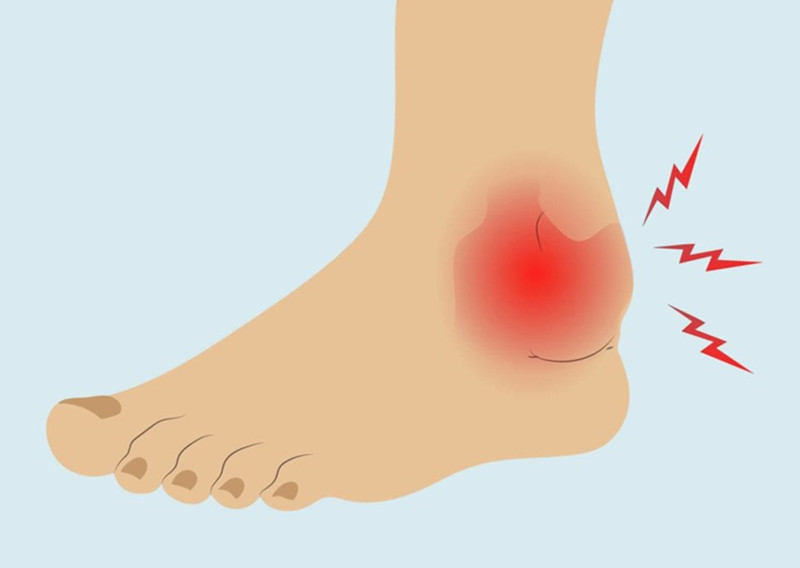 习惯性崴脚可以彻底治好吗,习惯性崴脚后怎么办
