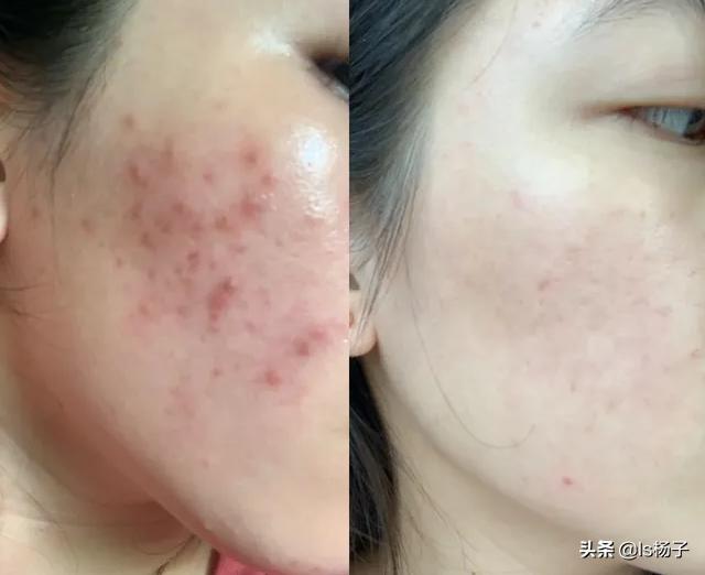 如何使皮肤变白的简单方法,让肤色变白的最快方法