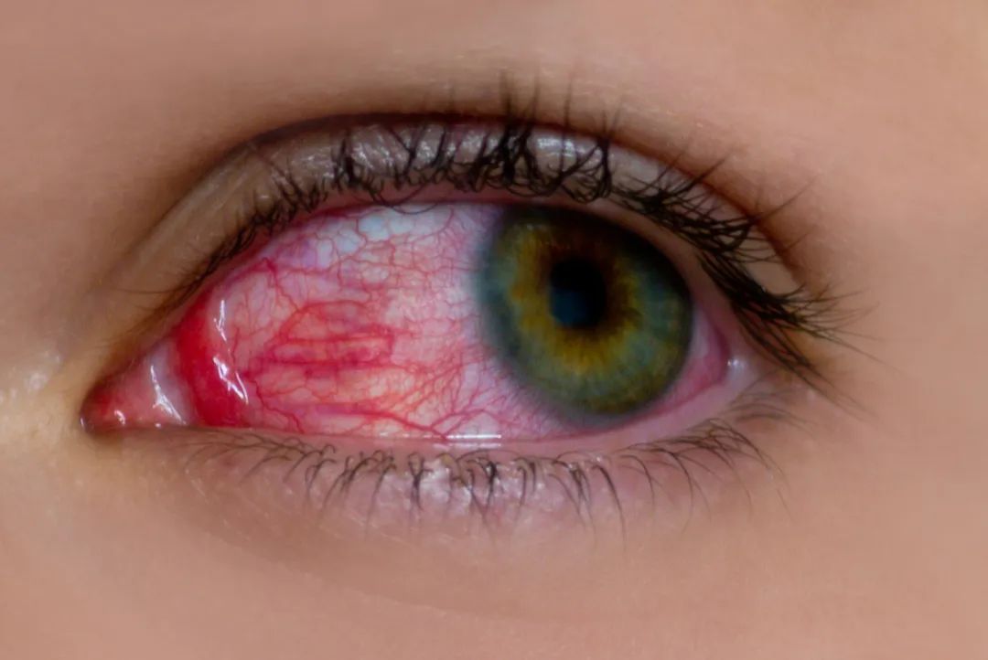 水上乐园妇科病,有妇科病能去水上乐园玩吗