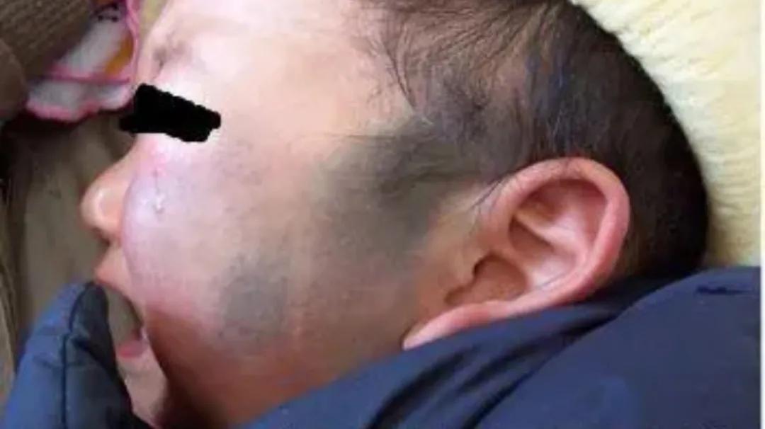 小孩不知道什么原因起红疹,孩子不明原因身上起红点