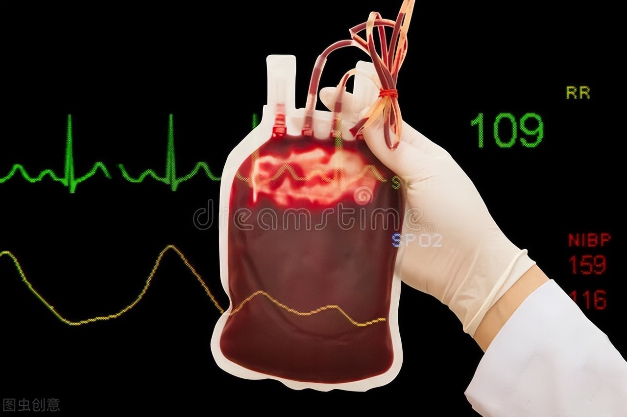 急性上消化道出血的输血策略