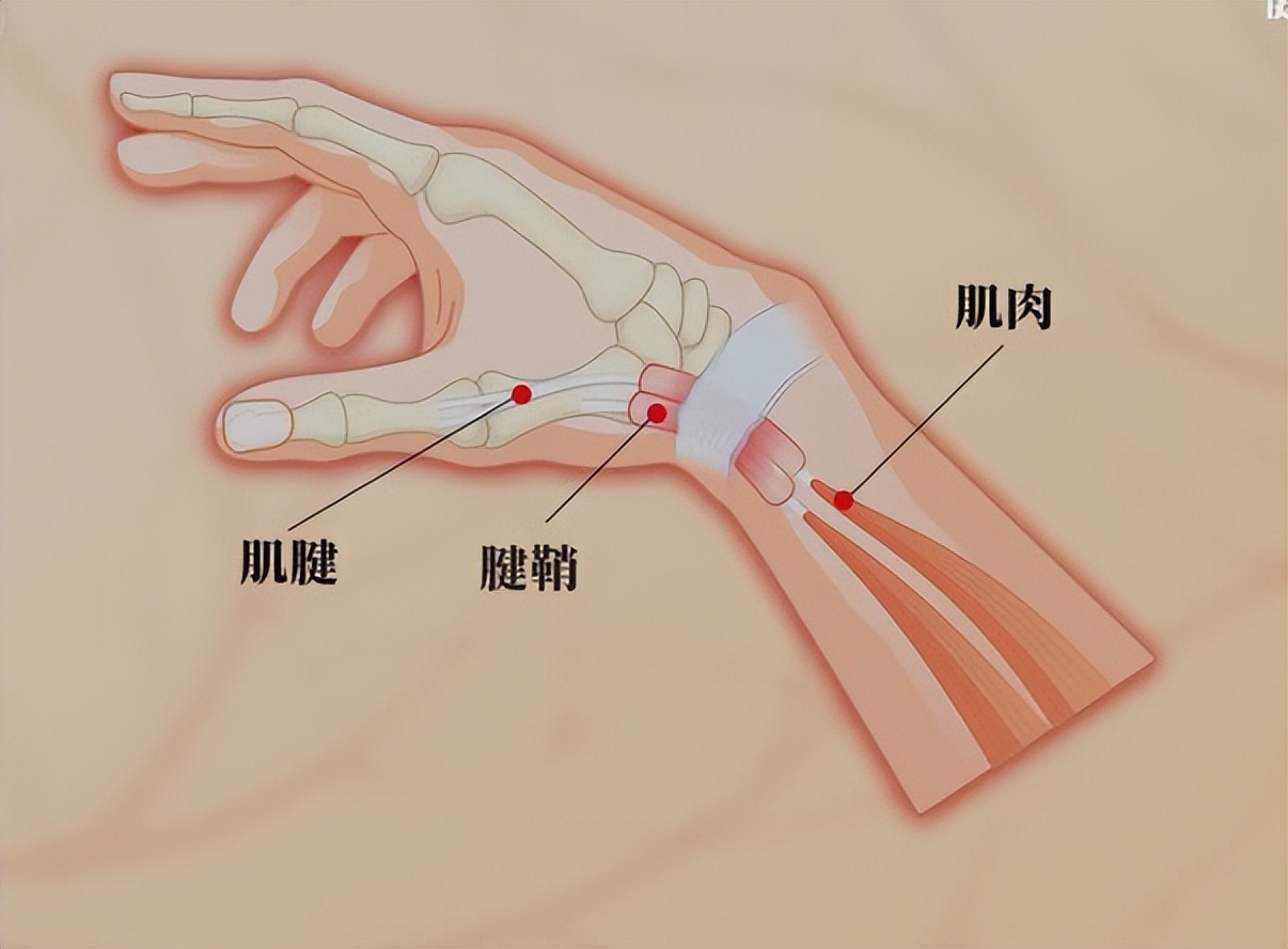 富血小板血浆因子作用,富血小板血浆治疗的目的和意义