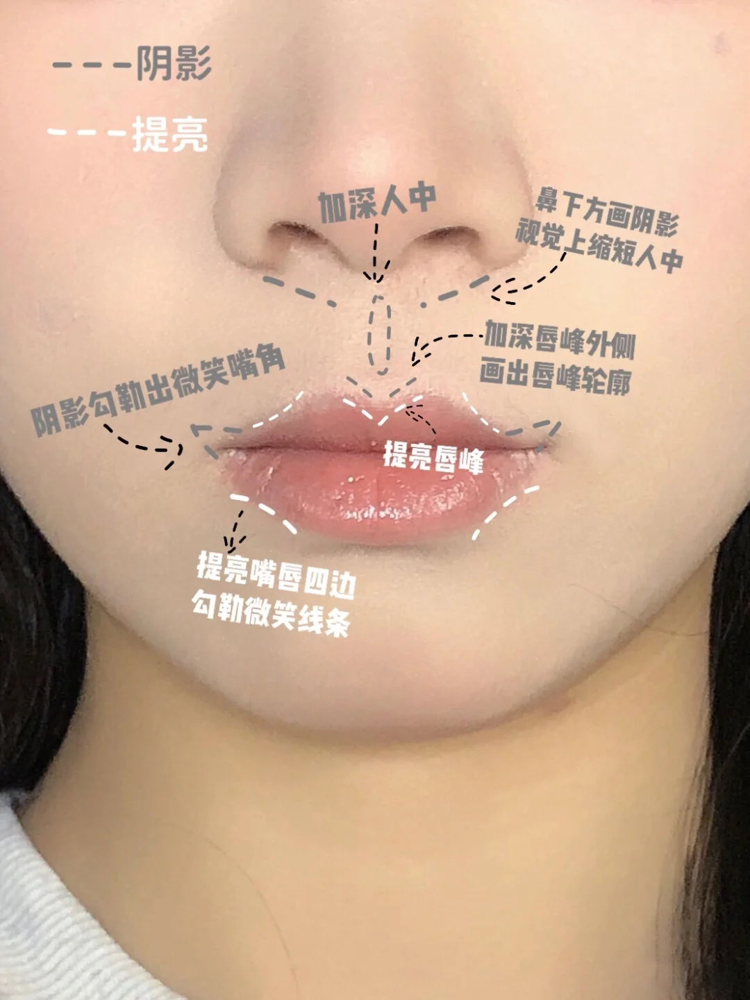 凸嘴矫正可以缩短人中吗,人中太长凸嘴怎么化妆缩短