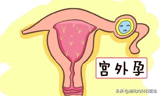 人流时出现子宫穿孔,大出血流产女子肚子疼