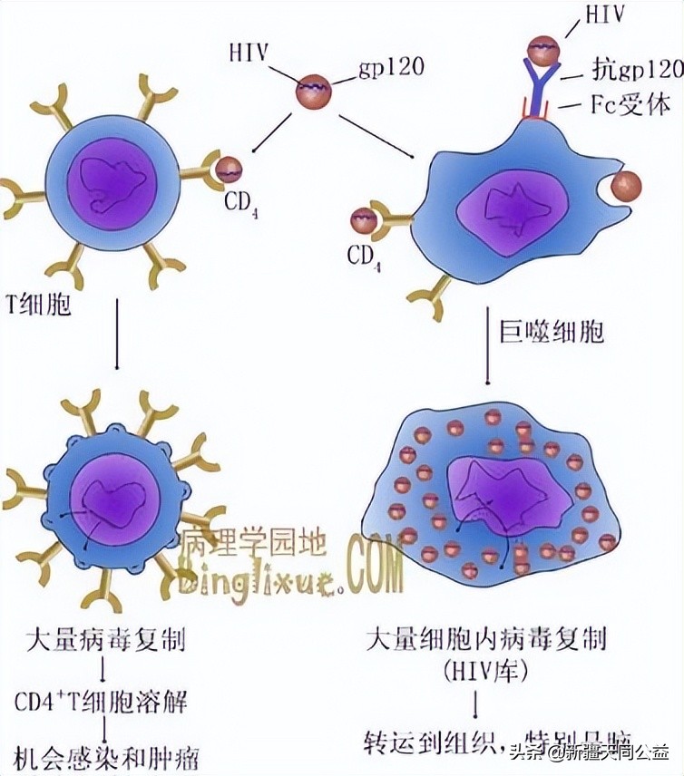 艾滋病感染者自述感染初期症状,一旦患上艾滋病还能活多久