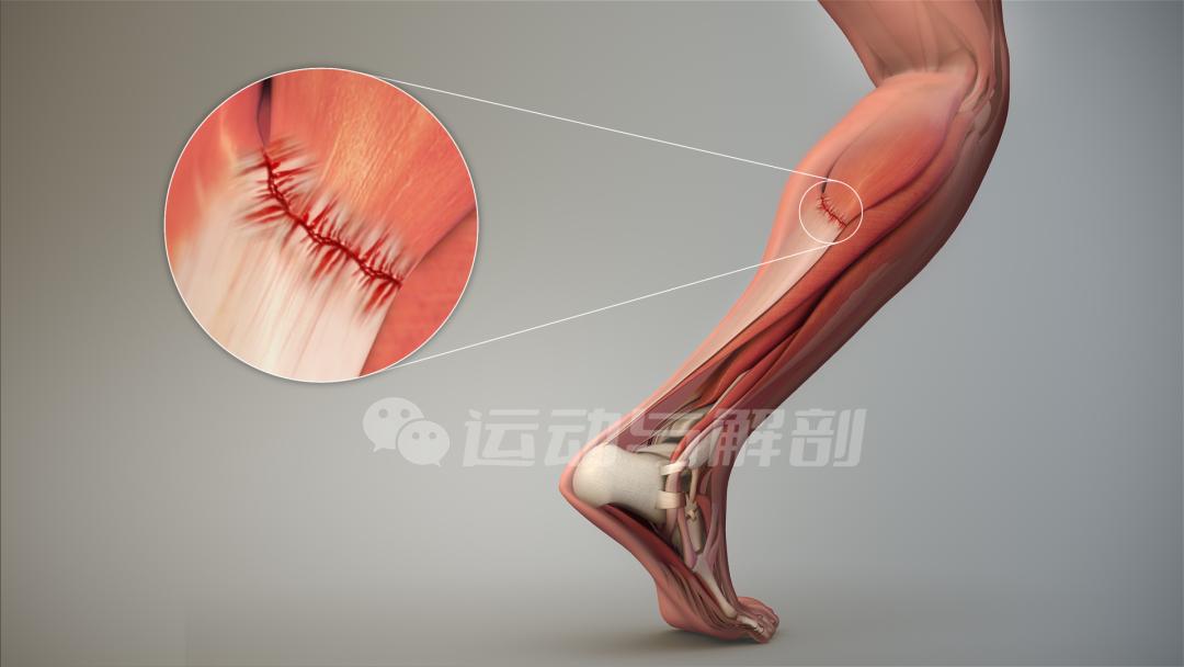跑步之前热身视频,跑步前热身运动不伤膝盖