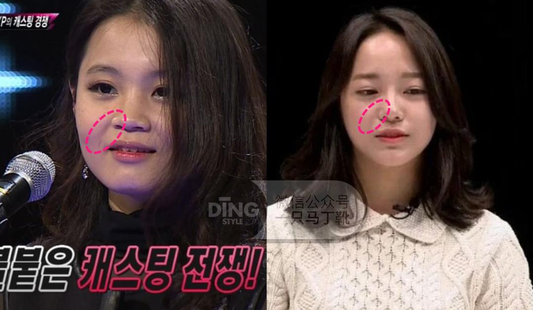 看上去疲惫怎么改善,很憔悴疲惫怎么改善