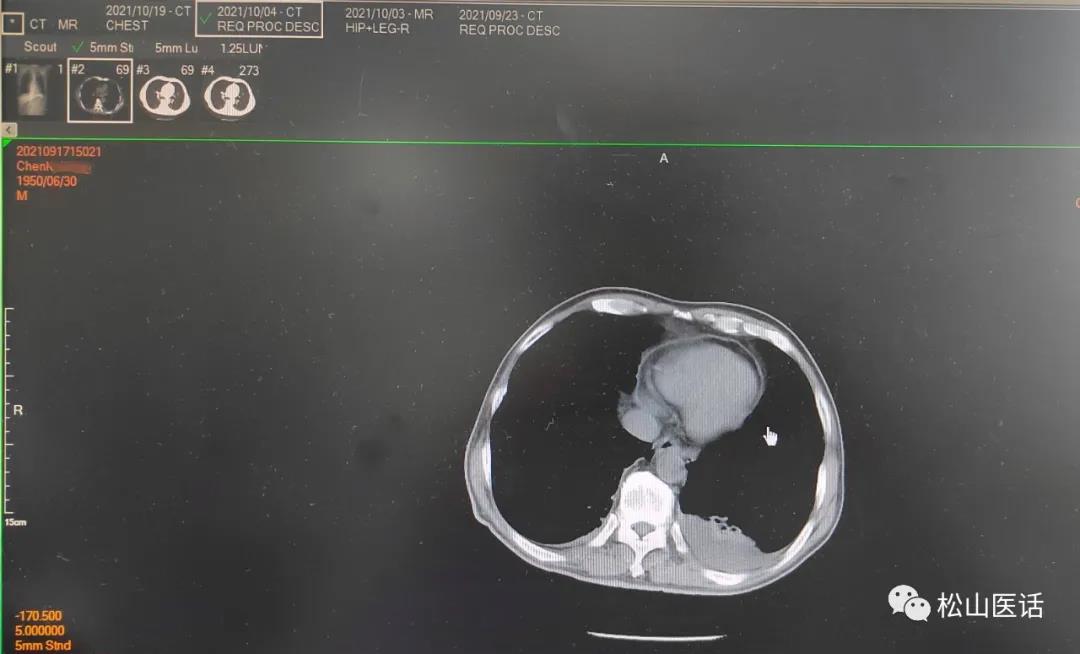 松山医话完整版,松山医话解说
