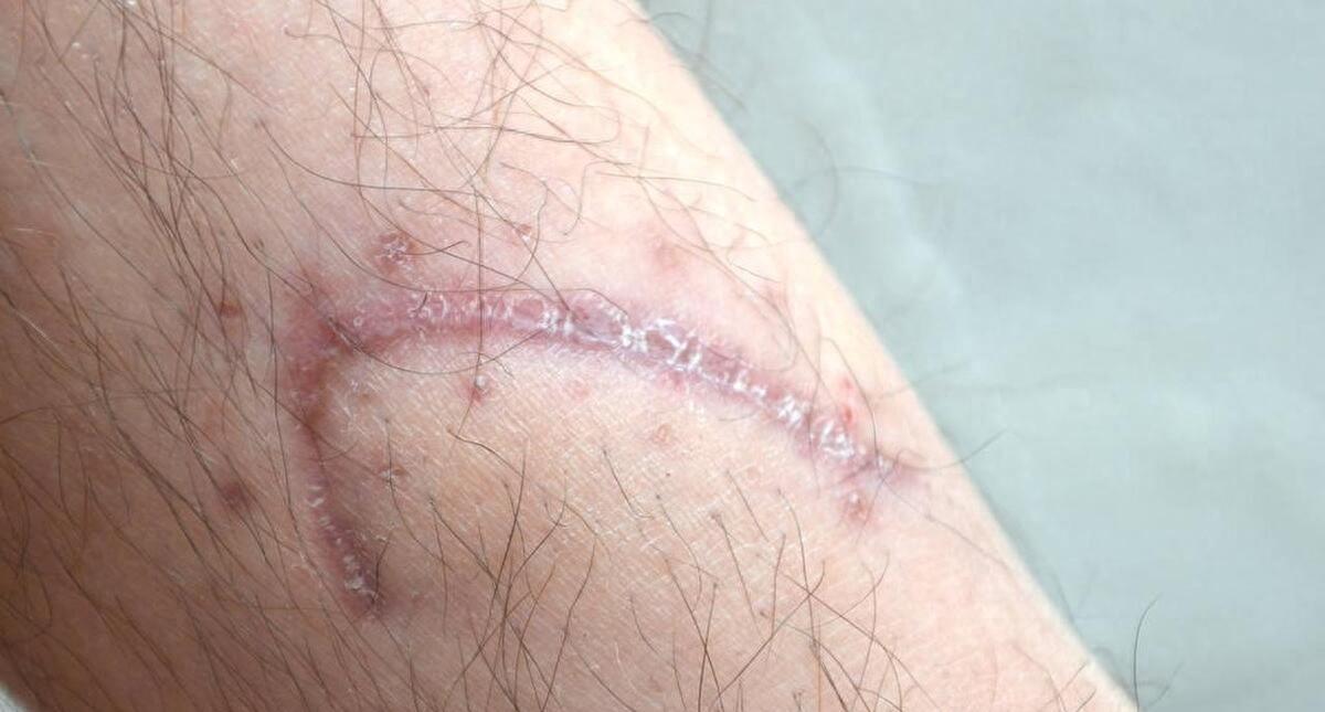 沐浴时，男友提出让我在“花园”上纹上他的名字，来证明我爱他