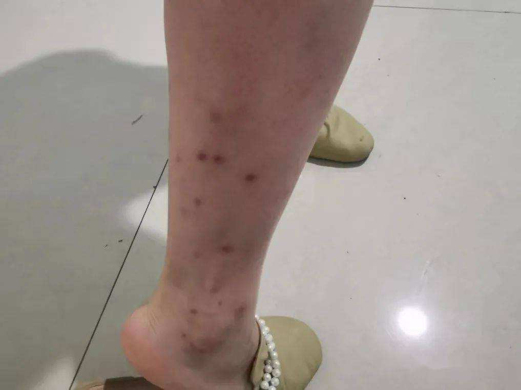 除跳蚤的喷雾,跳蚤药喷雾剂除蚤速度