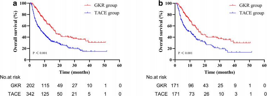 韩云炜西南医科大学附属医院,纳米刀治疗肝癌门静脉癌栓