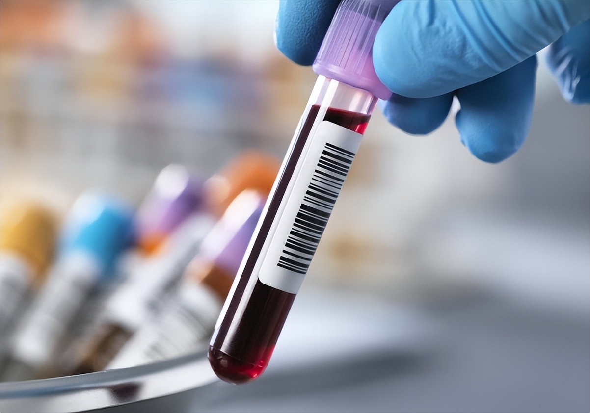 谷草转氨酶和谷丙转氨酶高怎么降,谷丙转氨酶谷草转氨酶高要查什么