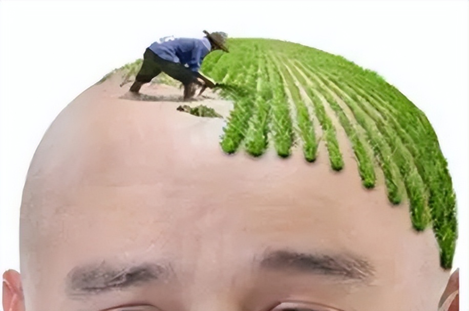 生发液排行榜第一名,生发液推荐平价学生