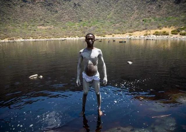 日薪60元的非洲采盐人，用命换钱，几年时间全身溃烂、耳聋失明