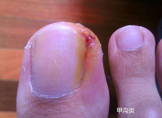 效果好的消炎消肿涂抹的药膏,哪种药膏可以长期使用又能消炎的