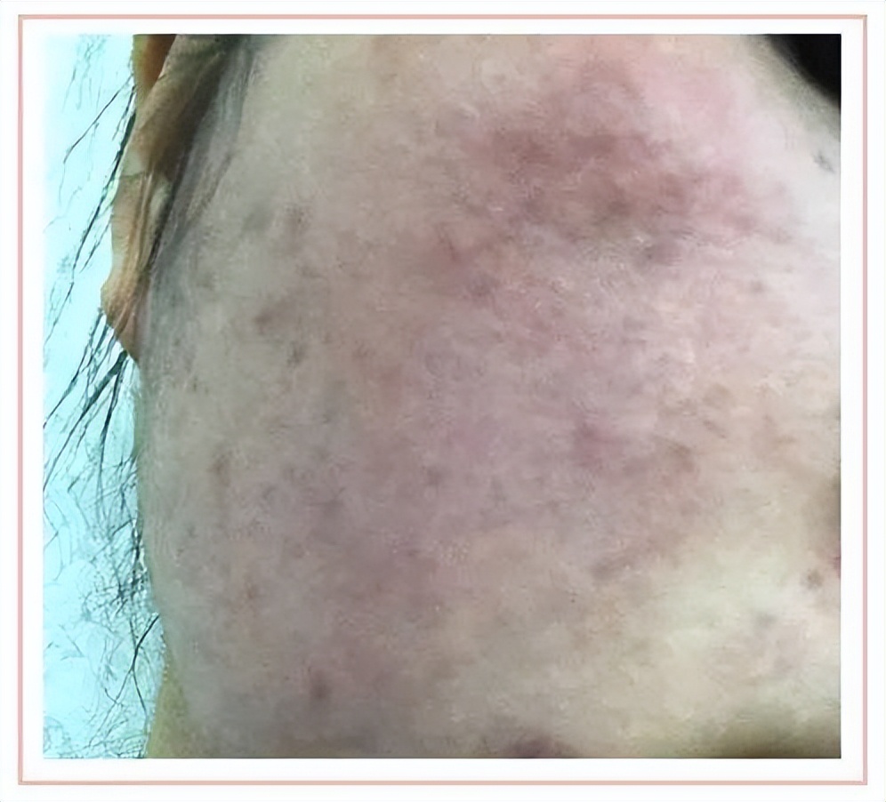 护肤品九大争议防腐剂,护肤品里面的防腐剂都有哪些