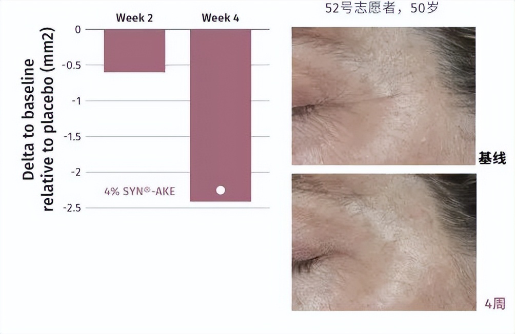 知道它的人不多，但四五十岁女性用了真的能淡纹，值得一看